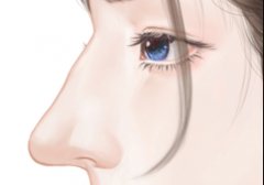 鼻尖怎么整形？相關(guān)注意事項(xiàng)介紹