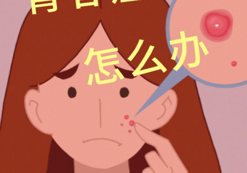 青春痘診療方法，技術優(yōu)勢有什么？